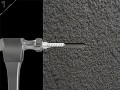 TOGGLER Alligator Soild Wall Anchors 5/16
